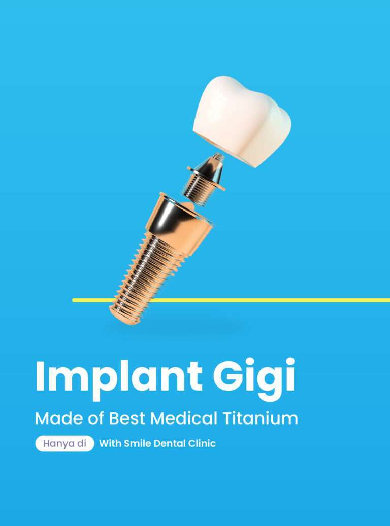 Dental Implant