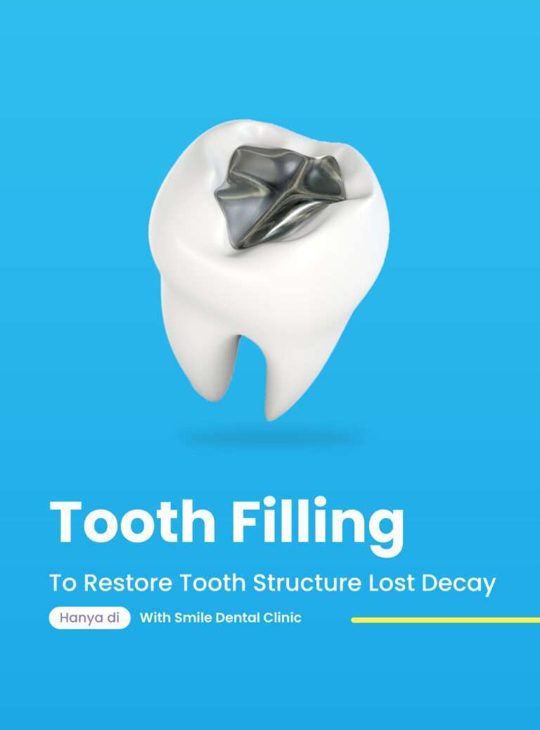 Tooth Filling