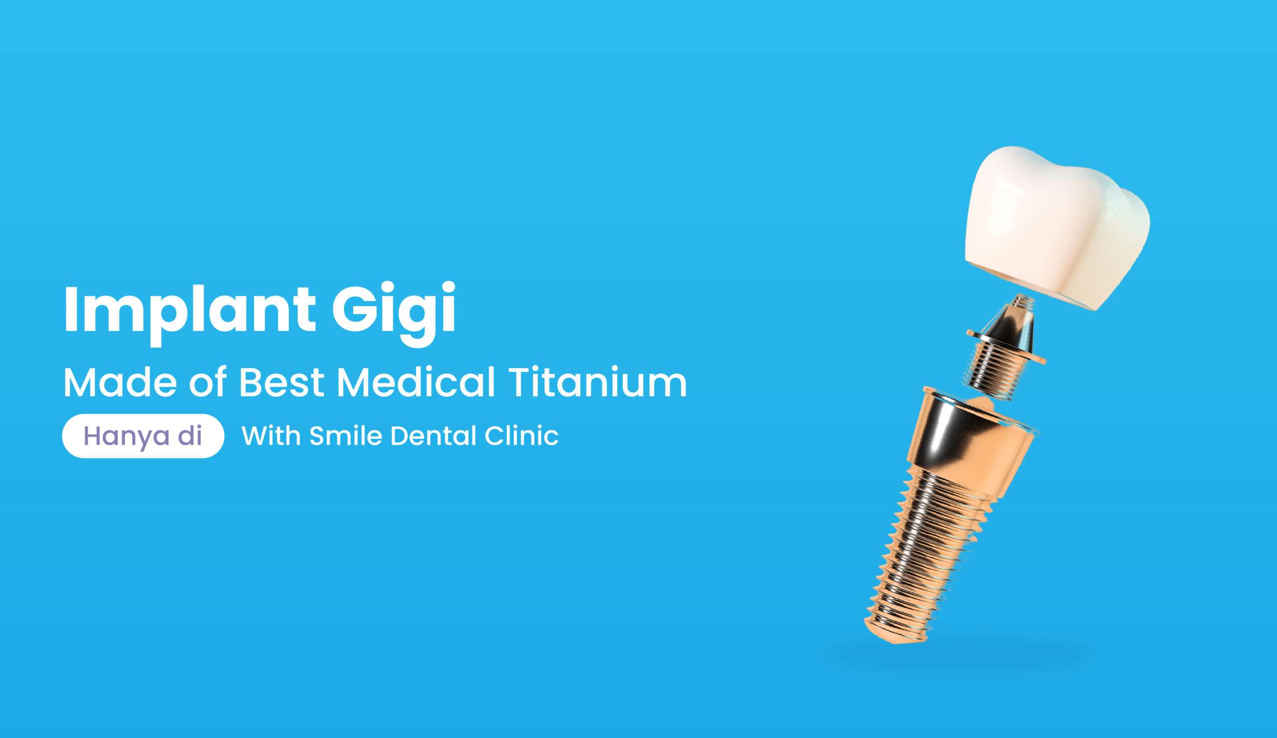 Implant