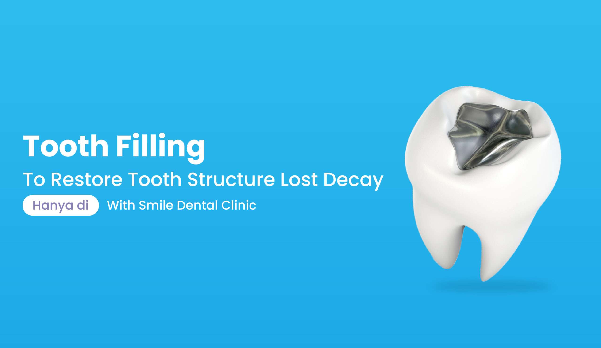 Tooth Filling