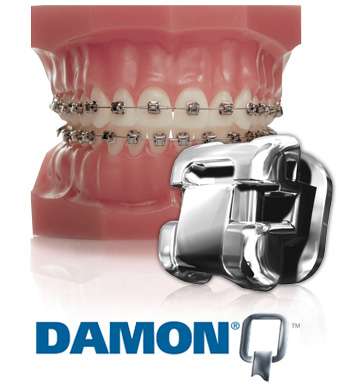 behel damon