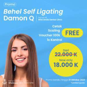 behel self ligating